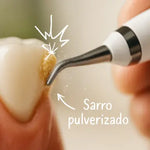 Sonic™ - Cepillo Eléctrico Removedor de Sarro
