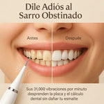 Sonic™ - Cepillo Eléctrico Removedor de Sarro